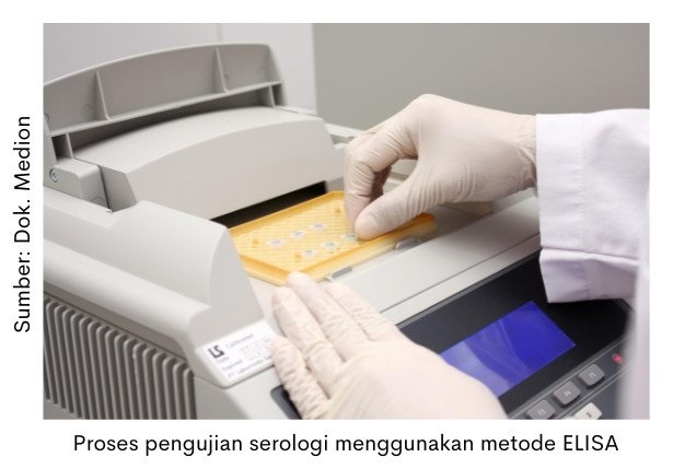 Kilas Balik Penyakit Unggas 2022 6 proses pengujian serologi