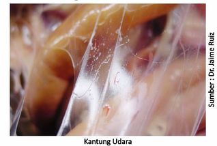 Titik Lemah Manajemen Penyebab CRD dan Korisa 3 40AU03 1