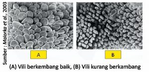 Optimalisasi Manajemen Pemeliharaan di Era Non AGP 2 A Villi berkembang baik B Vili kurang berkembang 300x146 1