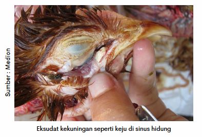 Waspadai Coryza saat Peralihan Musim 5 AU 5 2 1