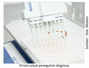 Strategi Menjaga kesehatan Pernapasan Ayam 14 Hi test untuk peneguhan diagnosa 300x228 1