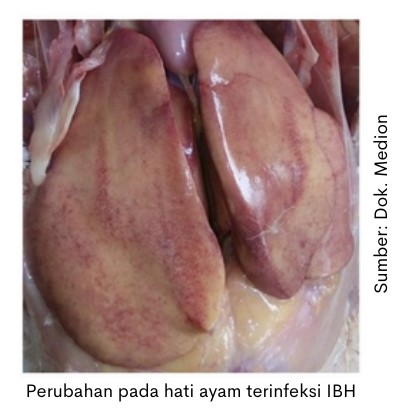 Penanganan Penyakit IBH 1 Hati ayam terinfeksi IBH