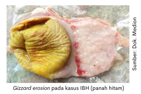 Penanganan Penyakit IBH 2 Gizzard erosion IBH
