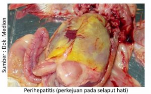 Strategi Menjaga kesehatan Pernapasan Ayam 4 Perihepatitis 300x187 1