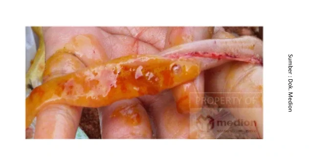 Resistensi Antiprotozoa pada Unggas 3 KT 3 e1761806300232