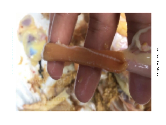 Cacingan pada Ayam Petelur : Dampak terhadap Performa dan Strategi Pengendaliannya 7 au 7