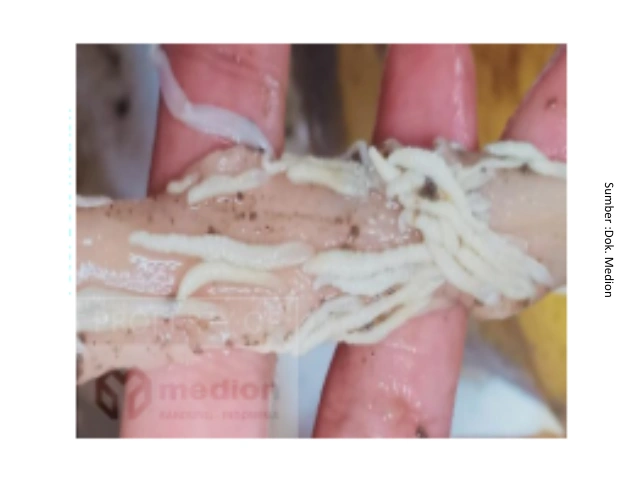 Cacingan pada Ayam Petelur : Dampak terhadap Performa dan Strategi Pengendaliannya 8 au 8